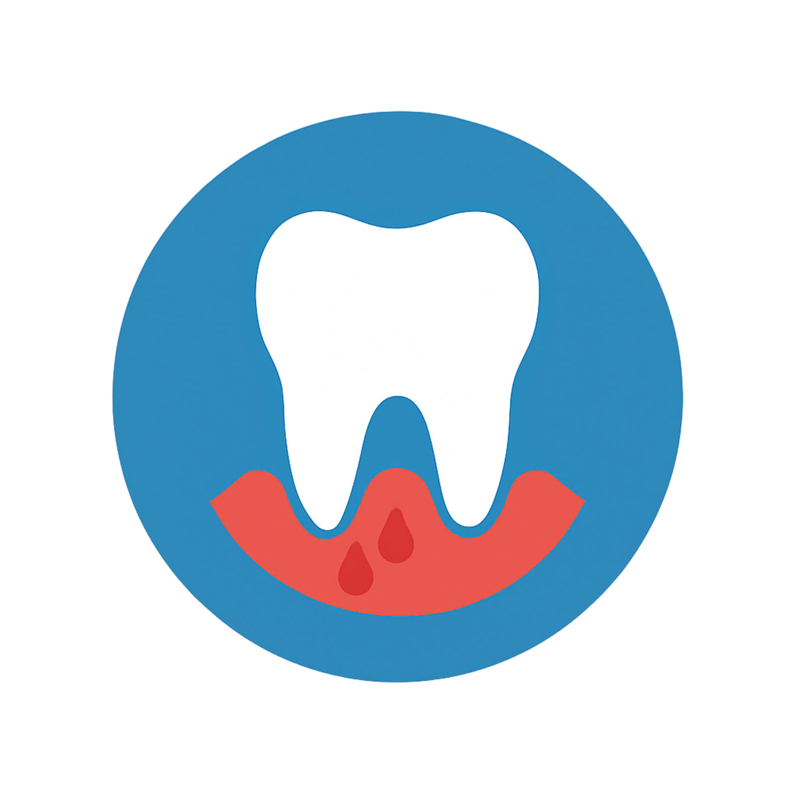 Periodontoloji (Diş Eti Hastalıkları)